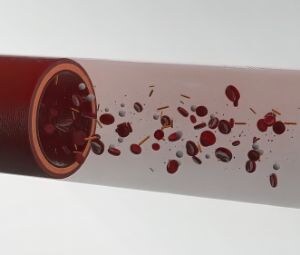 biopsia a nivel líquido